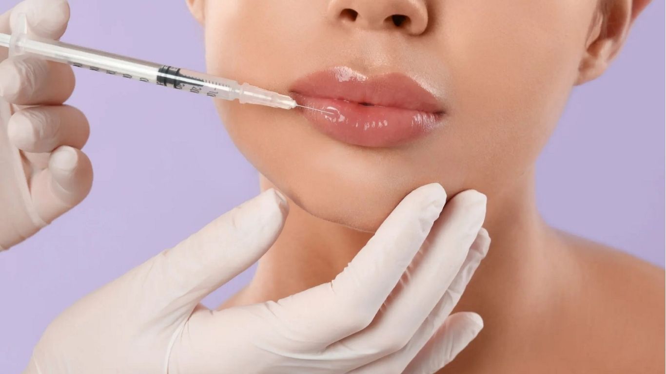 Dermal fillers