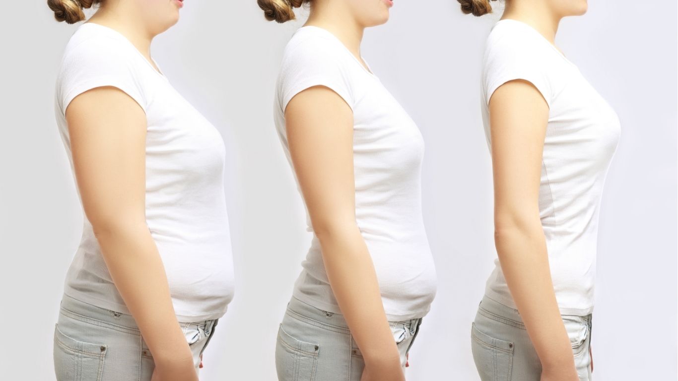 Medical weight loss treatment